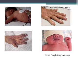 Fonte: Google Imagens, 2015.
 