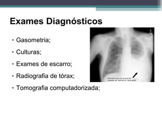 Exames Diagnósticos
• Gasometria;
• Culturas;
• Exames de escarro;
• Radiografia de tórax;
• Tomografia computadorizada;
 