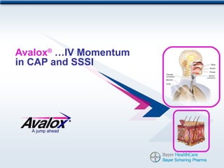 Avalox® …IV Momentum
in CAP and SSSI




  A jump ahead
 