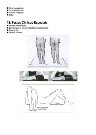 CCoorrrreerr ee ddeessaacceelleerraarr;;
CCoorrrreerr ee ffaazzeerr vvoollttaass;;
PPuullaarr eemm uummaa ppeerrnnaa;;
SSaallttaarr..
1122.. TTeesstteess CCllíínniiccooss EEssppeecciiaaiiss
SSiinnaall ddee TTrreennddeelleennbbuurrgg;;
DDiissccrreeppâânncciiaass nnoo ccoommpprriimmeennttoo ddooss mmeemmbbrrooss iinnffeerriioorreess..
TTeessttee ddee EEllyy;;
TTeessttee ddoo PPiirriiffoorrmmee..
 