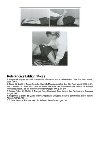 RReeffeerrêênncciiaass BBiibblliiooggrrááffiiccaass
11.. MMaarrqquueess AAPP.. ÂÂnngguullooss aarrttiiccuullaarreess ddooss mmeemmbbrrooss iinnffeerriioorreess.. IInn:: MMaannuuaall ddee GGoonniioommeettrriiaa.. 22 eedd.. SSããoo PPaauulloo:: MMaannoollee;;
22000033.. pp..3344--3399..
22.. MMaaggeeee DDJJ.. QQuuaaddrriill IInn:: MMaaggeeee,, DDJJ,, eeddiittoorr.. DDiissffuunnççããoo MMuussccuullooeessqquueellééttiiccaa.. 33 eedd.. SSããoo PPaauulloo:: MMaannoollee;; 22000022.. pp..552255--
661199.. 33.. PPaallmmeerr,, LLMM..;; EEpplleerr,, MMEE.. QQuuaaddrriill:: IInn:: PPaallmmeerr,, LLMM..;; EEpplleerr,, MMEE.. FFuunnddaammeennttooss ddaass TTééccnniiccaass ddee AAvvaalliiaaççããoo
MMuussccuullooeessqquueellééttiiccaa.. 22 eedd.. RRiioo ddee JJaanneeiirroo:: GGuuaannaabbaarraa KKooooggaann;; 22000000.. pp..225500--227744..
33.. GGaarrddnneerr EE,, GGrraayy DDJJ,, OO’’RRaahhiillllyy RR.. AAnnaattoommiiaa.. EEssttuuddoo RReeggiioonnaall ddoo CCoorrppoo HHuummaannoo.. 44 eedd.. RRiioo ddee JJaanneeiirroo:: GGuuaannaabbaarraa
KKooooggaann,, 11998888..
44.. HHooppppeennffeelldd,, SS.. EExxaammee ddoo QQuuaaddrriill ee PPeellvvee.. PPrrooppeeddêêuuttiiccaa OOrrttooppééddiiccaa.. CCoolluunnaa ee EExxttrreemmiiddaaddeess.. RRiioo ddee JJaanneeiirroo::
AAtthheenneeuu,, 11998877 pppp.. 114499--117777..
55.. SSoobboottttaa,, JJ.. AAttllaass ddee AAnnaattoommiiaa.. 2200eedd..,, RRiioo ddee JJaanneeiirroo:: GGuuaannaabbaarraa KKooooggaann,, 11999933..
 