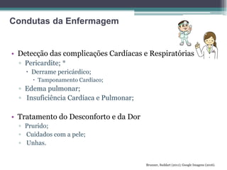 • Detecção das complicações Cardíacas e Respiratórias
▫ Pericardite; *
 Derrame pericárdico;
 Tamponamento Cardíaco;
▫ Edema pulmonar;
▫ Insuficiência Cardíaca e Pulmonar;
• Tratamento do Desconforto e da Dor
▫ Prurido;
▫ Cuidados com a pele;
▫ Unhas.
Brunner, Suddart (2011); Google Imagens (2016).
Condutas da Enfermagem
 