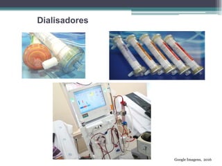 Dialisadores
Google Imagens, 2016
 