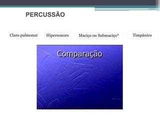 PERCUSSÃO
Claro pulmonar Hipersonoro Maciço ou Submaciço* Timpânico
 