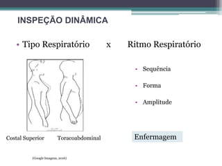 • Tipo Respiratório x Ritmo Respiratório
INSPEÇÃO DINÂMICA
Costal Superior Toracoabdominal
• Sequência
• Forma
• Amplitude
(Google Imagens, 2016)
Enfermagem
 