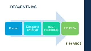 DESVENTAJAS
Fricción
Desgaste
articular
Dolor
Incapacidad
REVISIÓN
5-10 AÑOS
 