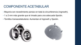 COMPONENTE ACETABULAR
• Mayoría con revestimiento poroso en toda la circunferencia (ingrowth).
• 1 a 2 mm más grande que el rimado para una adecuada fijación.
• Tornillos transacetabulares: Aumentan el Ingrowth y fijación.
 
