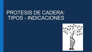 PROTESIS DE CADERA:
TIPOS - INDICACIONES
 