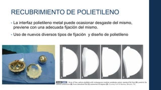 RECUBRIMIENTO DE POLIETILENO
• La interfaz polietileno metal puede ocasionar desgaste del mismo,
previene con una adecuada fijación del mismo.
• Uso de nuevos diversos tipos de fijación y diseño de polietileno
 