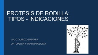 PROTESIS DE RODILLA:
TIPOS - INDICACIONES
JULIO QUIROZ GUEVARA
ORTOPEDIA Y TRAUMATOLOGÍA
 