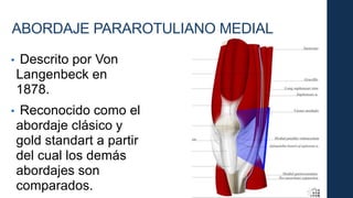 • Descrito por Von
Langenbeck en
1878.
• Reconocido como el
abordaje clásico y
gold standart a partir
del cual los demás
abordajes son
comparados.
ABORDAJE PARAROTULIANO MEDIAL
 