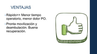 • Rápido>> Menor tiempo
operatorio, menor dolor PO.
• Pronta movilización y
deambulación. Buena
recuperación.
VENTAJAS
 
