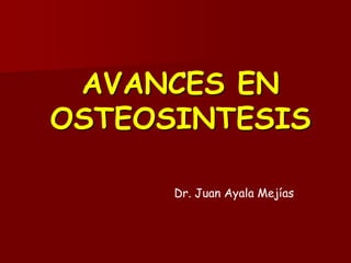 AVANCES EN
OSTEOSINTESIS
Dr. Juan Ayala Mejías
 