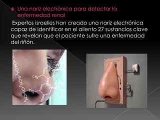 Una nariz electrónica para detectar la enfermedad renalExpertos israelíes han creado una nariz electrónica capaz de identificar en el aliento 27 sustancias clave que revelan que el paciente sufre una enfermedad del riñón.