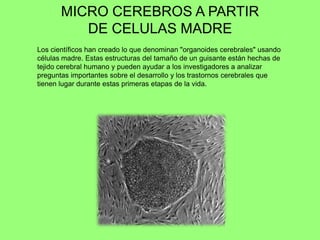 MICRO CEREBROS A PARTIR
DE CELULAS MADRE
Los científicos han creado lo que denominan "organoides cerebrales" usando
células madre. Estas estructuras del tamaño de un guisante están hechas de
tejido cerebral humano y pueden ayudar a los investigadores a analizar
preguntas importantes sobre el desarrollo y los trastornos cerebrales que
tienen lugar durante estas primeras etapas de la vida.
 