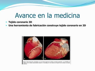Avance en la medicina
 Tejido coronario 3D
 Una herramienta de fabricación construye tejido coronario en 3D
 