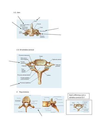 1-2 : Axis
1-3- VII vértebra cervical
2- Peça torácica
Qual a diferença com a
vértebra cervical C3 ?
 