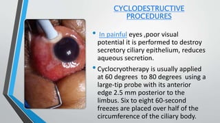 CYCLODESTRUCTIVE
PROCEDURES
• In painful eyes ,poor visual
potential it is performed to destroy
secretory ciliary epithelium, reduces
aqueous secretion.
•Cyclocryotherapy is usually applied
at 60 degrees to 80 degrees using a
large-tip probe with its anterior
edge 2.5 mm posterior to the
limbus. Six to eight 60-second
freezes are placed over half of the
circumference of the ciliary body.
 