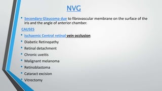 NVG
• Secondary Glaucoma due to fibrovascular membrane on the surface of the
iris and the angle of anterior chamber.
CAUSES
• Ischaemic Central retinal vein occlusion
• Diabetic Retinopathy
• Retinal detachment
• Chronic uveitis
• Malignant melanoma
• Retinoblastoma
• Cataract excision
• Vitrectomy
 