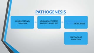 PATHOGENESIS
CHRONIC RETINAL
ISCHAEMIA
ANGIOGENIC FACTORS
RELEASED & DIFFUSED
NEOVASCULARISATION ON
IRIS AND IN THE ANGLE
NEOVASCULAR
GLAUCOMA
 