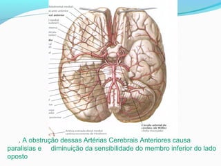 . A obstrução dessas Artérias Cerebrais Anteriores causa
paralisias e diminuição da sensibilidade do membro inferior do lado
oposto
 