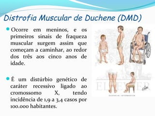 Distrofia Muscular de Duchene (DMD)
Ocorre em meninos, e os
primeiros sinais de fraqueza
muscular surgem assim que
começam a caminhar, ao redor
dos três aos cinco anos de
idade.
É um distúrbio genético de
caráter recessivo ligado ao
cromossomo X, tendo
incidência de 1,9 a 3,4 casos por
100.000 habitantes.
 
