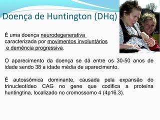 É uma doença neurodegenerativa
caracterizada por movimentos involuntários
e demência progressiva.
O aparecimento da doença se dá entre os 30-50 anos de
idade sendo 38 a idade média de aparecimento.
É autossômica dominante, causada pela expansão do
trinucleotídeo CAG no gene que codifica a proteína
huntingtina, localizado no cromossomo 4 (4p16.3).
Doença de Huntington (DHq)
 
