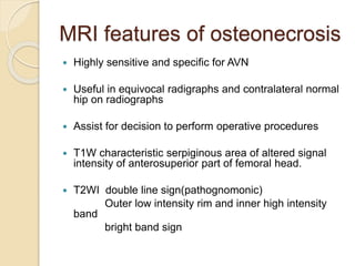 MRI features of osteonecrosis
 Highly sensitive and specific for AVN
 Useful in equivocal radigraphs and contralateral normal
hip on radiographs
 Assist for decision to perform operative procedures
 T1W characteristic serpiginous area of altered signal
intensity of anterosuperior part of femoral head.
 T2WI double line sign(pathognomonic)
Outer low intensity rim and inner high intensity
band
bright band sign
 