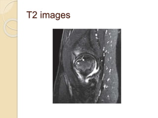 T2 images
 