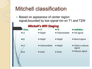 Mitchell classification
 Based on appearace of center region
signal,bounded by low signal rim on T1 and T2W
images
 Class A –fat like signal characteristic
early stages of disease
Class B-subacute blood like
high signal on both T1 and T2
Class C-Fluid like signal intensity
Class D- fibrous tissue like changes
 