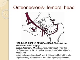 Osteonecrosis- femoral head
VASCULAR SUPPLY: FEMORAL HEAD. There are two
sources of blood supply:
profunda femoris (1)and ligamentum teres (2). From the
profunda femoris the circumflex vessels (3 and 4) provide the
medial and
lateral epiphyseal arteries (5 and 6). It is probable that the site
of precipitating occlusion is at the lateral epiphyseal vessels.
 
