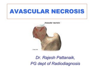 AVASCULAR NECROSIS
Dr. Rajesh Pattanaik,
PG dept of Radiodiagnosis
 