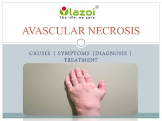 CAUSES | SYMPTOMS |DIAGNOSIS |
TREATMENT
AVASCULAR NECROSIS
 