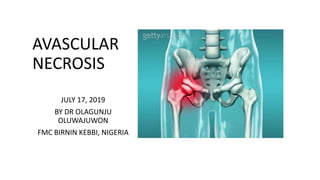 AVASCULAR
NECROSIS
JULY 17, 2019
BY DR OLAGUNJU
OLUWAJUWON
FMC BIRNIN KEBBI, NIGERIA
 