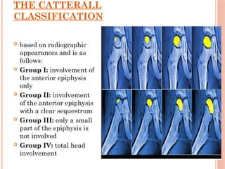 avascular necrosis in different joints.pptx