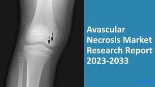 Avascular
Necrosis Market
Research Report
2023-2033
 