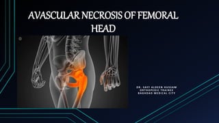 AVASCULAR NECROSIS OF FEMORAL
HEAD
D R . S AY F A L D E E N H U S S A M
O R T H O P E D I C T R A I N E E
B A G H DA D M E D I C A L C I T Y
 