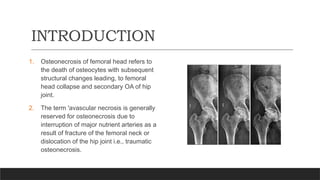 AVASCULAR NECROSIS OF FEMORAL HEAD [Autosaved].pptx