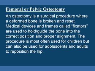 Femoral or Pelvic Osteotomy
An osteotomy is a surgical procedure where
a deformed bone is broken and reset.
Medical device...