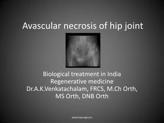 Avascular necrosis of hip joint
Biological treatment in India
Regenerative medicine
Dr.A.K.Venkatachalam, FRCS, M.Ch Orth,
MS Orth, DNB Orth
www.hipsurgery.in
 