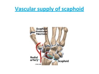 Vascular supply of scaphoid
 