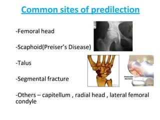 Common sites of predilection
-Femoral head
-Scaphoid(Preiser’s Disease)
-Talus
-Segmental fracture
-Others – capitellum , radial head , lateral femoral
condyle
 