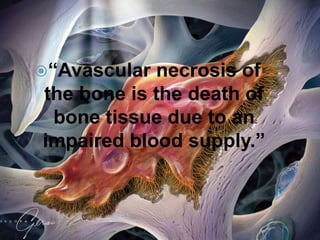 “Avascular necrosis of
the bone is the death of
bone tissue due to an
impaired blood supply.”
 