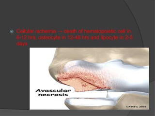  Cellular ischemia → death of hematopoietic cell in
6-12 hrs, osteocyte in 12-48 hrs and lipocyte in 2-5
days
 