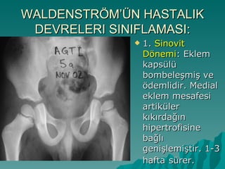 WALDENSTRÖM’ÜN HASTALIK
 DEVRELERI SINIFLAMASI:
                 1. Sinovit
                  Dönemi: Eklem
                  kapsülü
                  bombeleşmiş ve
                  ödemlidir. Medial
                  eklem mesafesi
                  artiküler
                  kıkırdağın
                  hipertrofisine
                  bağlı
                  genişlemiştir. 1-3
                  hafta sürer.
 