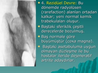  4. Rezidüel Devre: Bu
  dönemde radyolüsen
  (rarefaction) alanları ortadan
  kalkar; yeni normal kemik
  trabekulaları oluşur.
 Baştaki sferiklik çeşitli
  derecelerde bozulmuş.
 Baş normale göre
  büyümüştür (coxa magna).
 Baştaki asetabuluma uygun
  olmayan düzleşme ile bu
  hastalar ileride dejeneratif
  artrite adaydırlar.
 