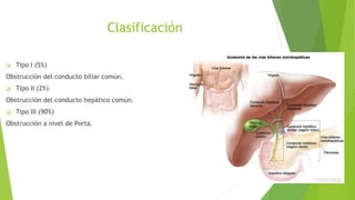 Clasificación
 Tipo I (5%)
Obstrucción del conducto biliar común.
 Tipo II (2%)
Obstrucción del conducto hepático común.
 Tipo III (90%)
Obstrucción a nivel de Porta.
 