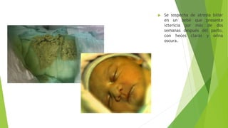  Se sospecha de atresia biliar
en un bebé que presente
ictericia por más de dos
semanas después del parto,
con heces claras y orina
oscura.
 
