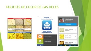 TARJETAS DE COLOR DE LAS HECES
 