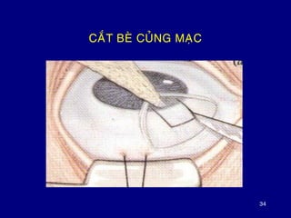 34
CAÉT BEØ CUÛNG MAÏC
 